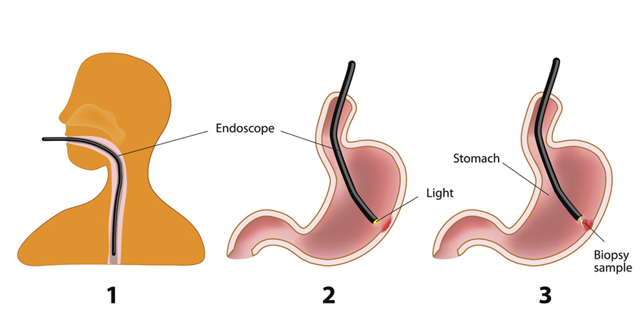 Endoscopy Image